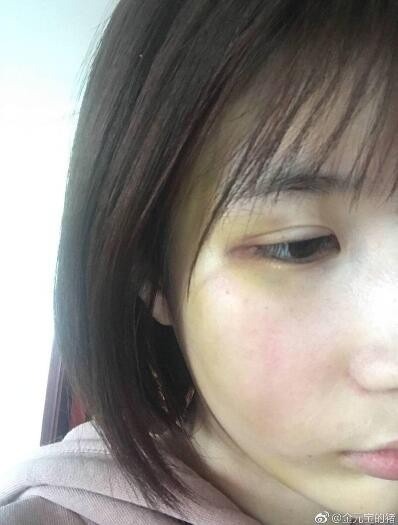 Đại Kim tố cáo Hứa Khải bạo lực