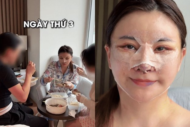 Visual trẻ trung của Kim Oanh sau phẫu thuật
