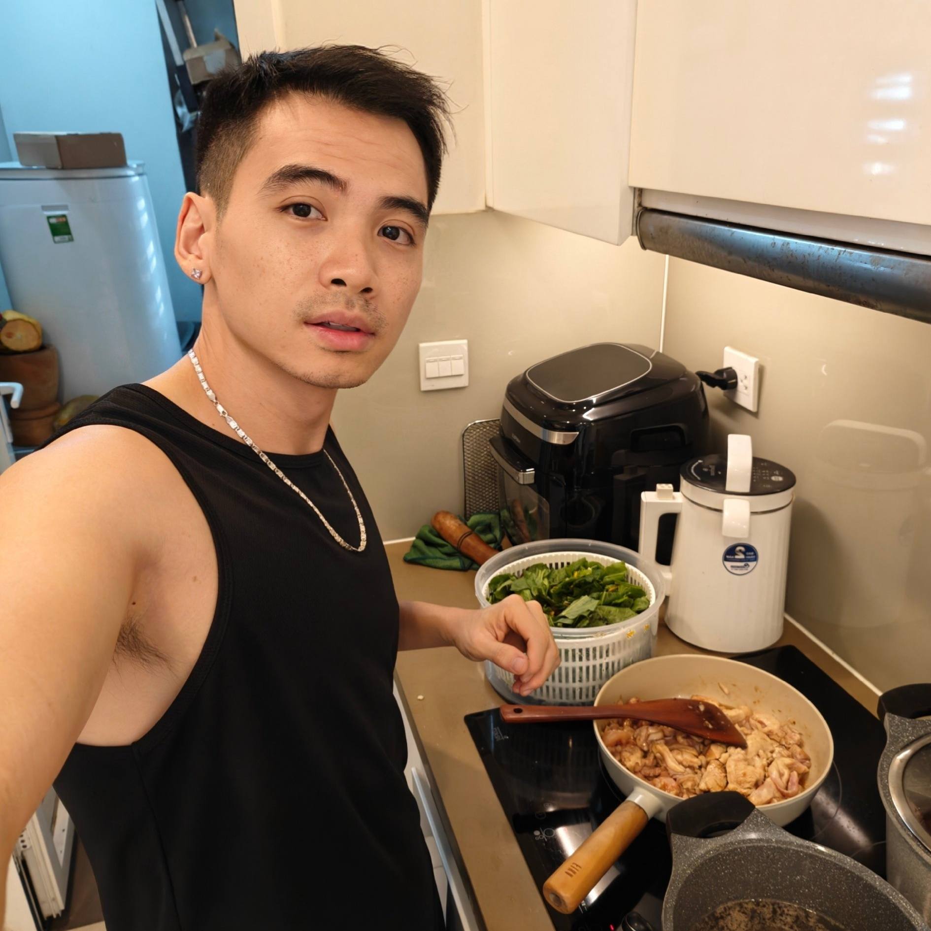 Kết quả cấy tóc sau 5 tháng