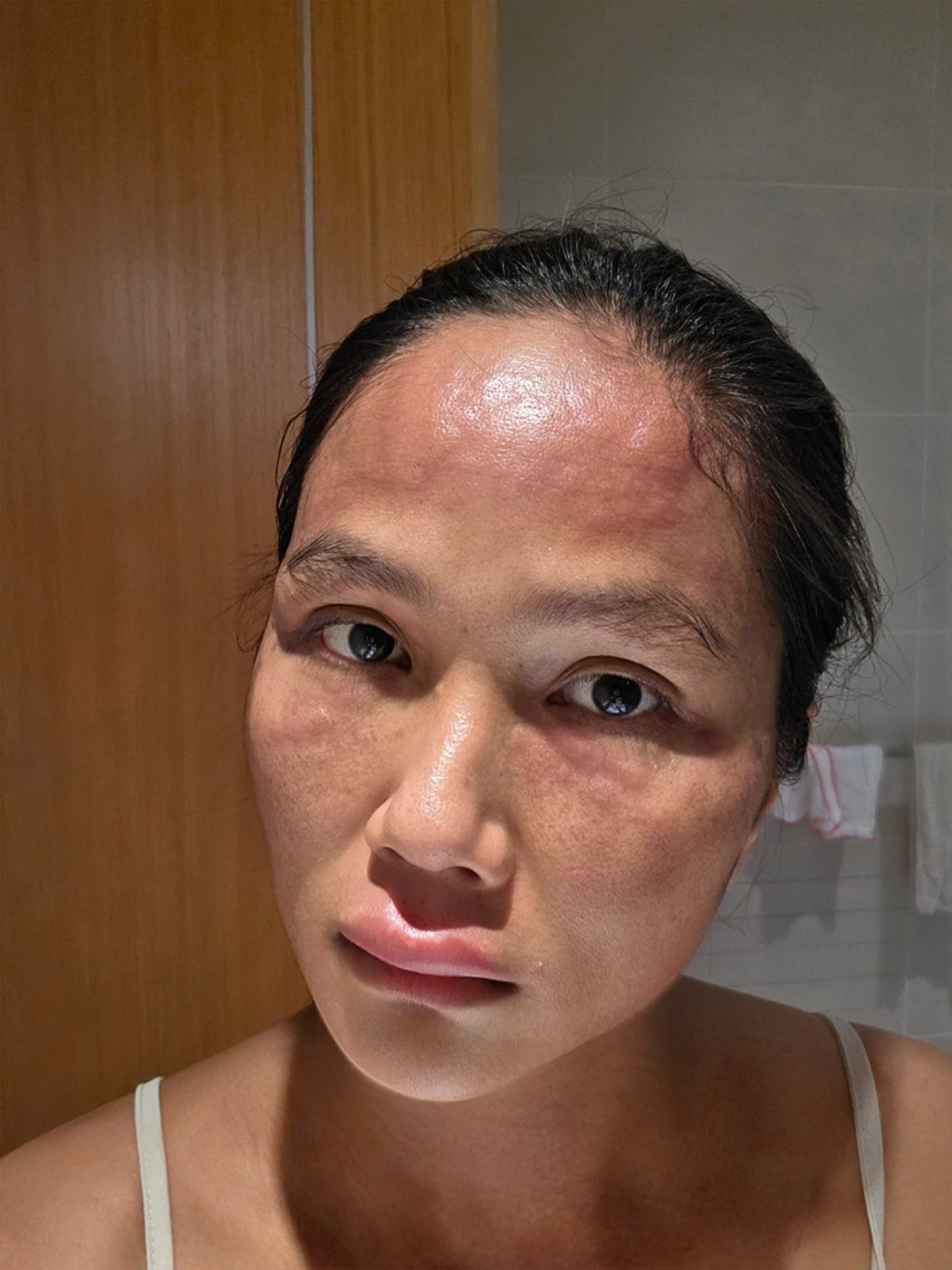 Chuyện gì xảy ra với H'Hen Niê sau khi xuất hiện với gương mặt khác lạ- Ảnh 2. H'Hen Niê gây lo lắng khi chia sẻ gương mặt bị biến dạng sau sinh