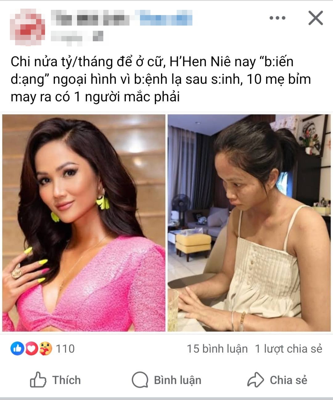 Chuyện gì xảy ra với H'Hen Niê sau khi xuất hiện với gương mặt khác lạ- Ảnh 3. H'Hen Niê phản hồi tin đồn về gương mặt
