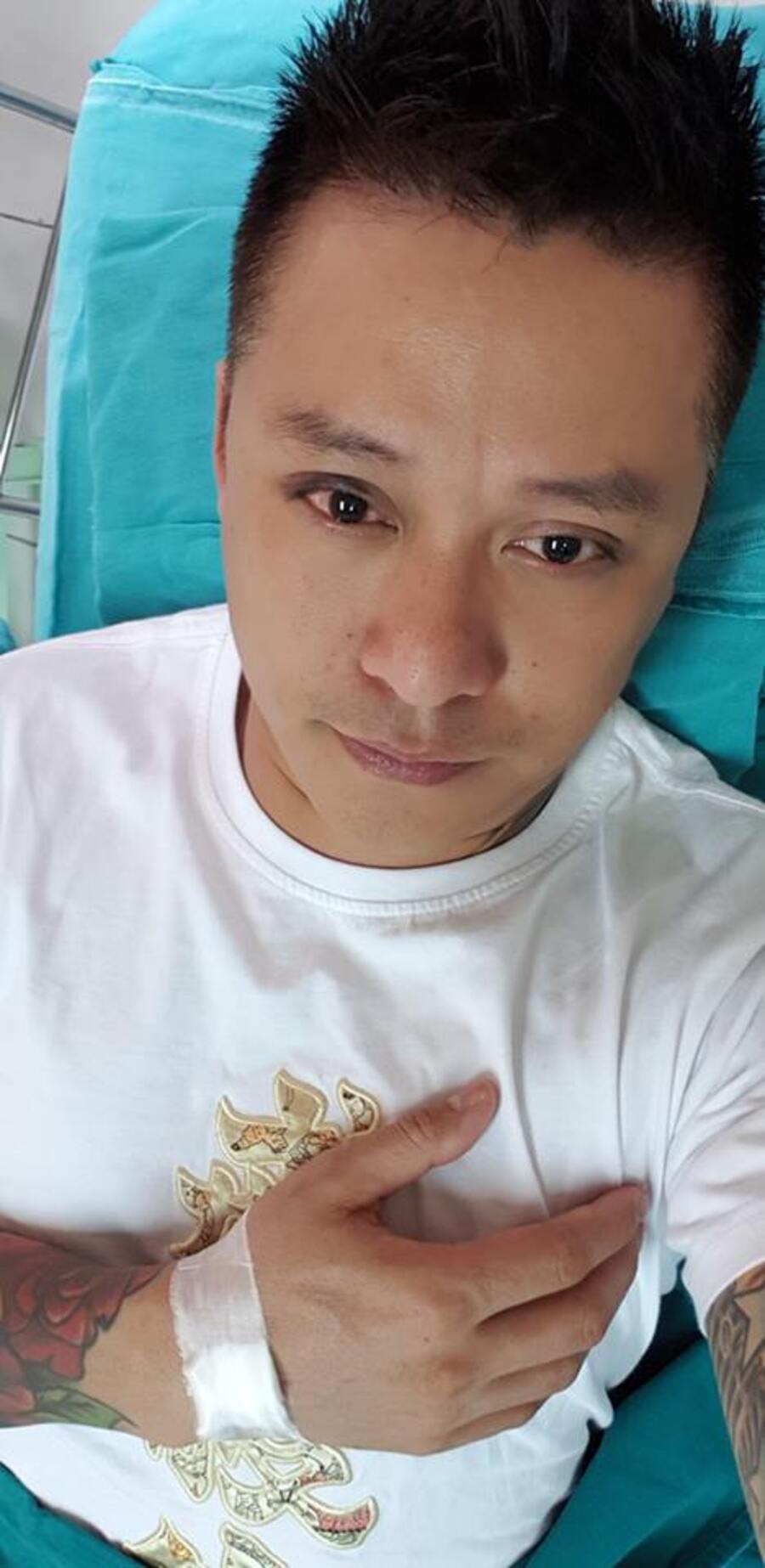 Thị lực của Tuấn Hưng giảm còn 4/10 Ảnh chụp mắt của Tuấn Hưng sau chấn thương