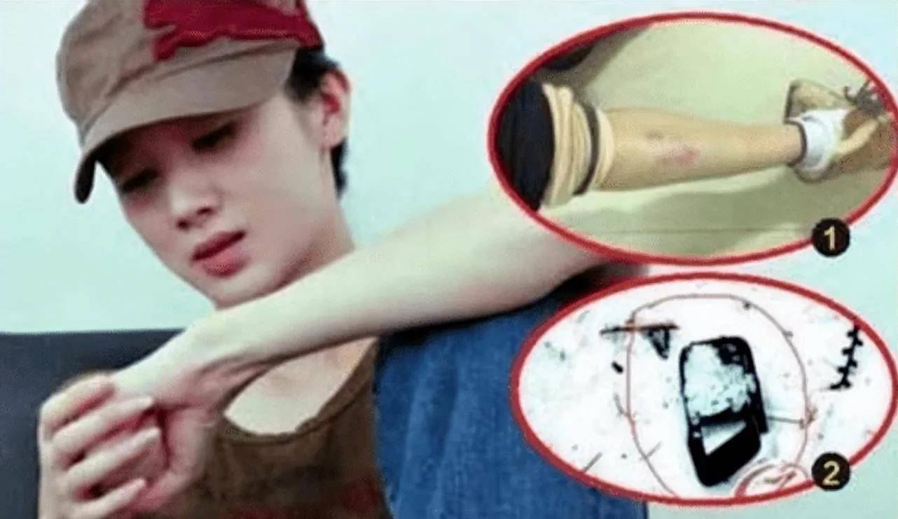 Vụ bạo hành trên phim trường để lại ám ảnh cho Tôn Phi Phi