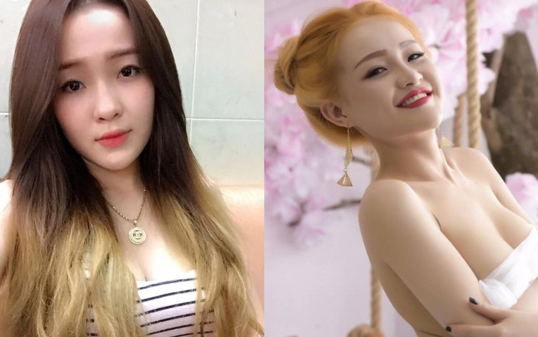 Gương mặt Ngân 98 trước khi phẫu thuật