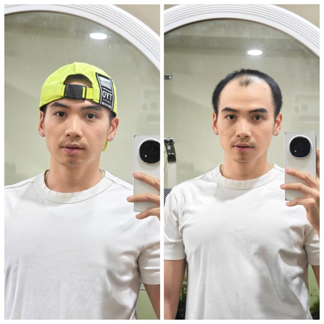 Chồng hoa hậu H'Hen Niê đội mũ vì hói đầu