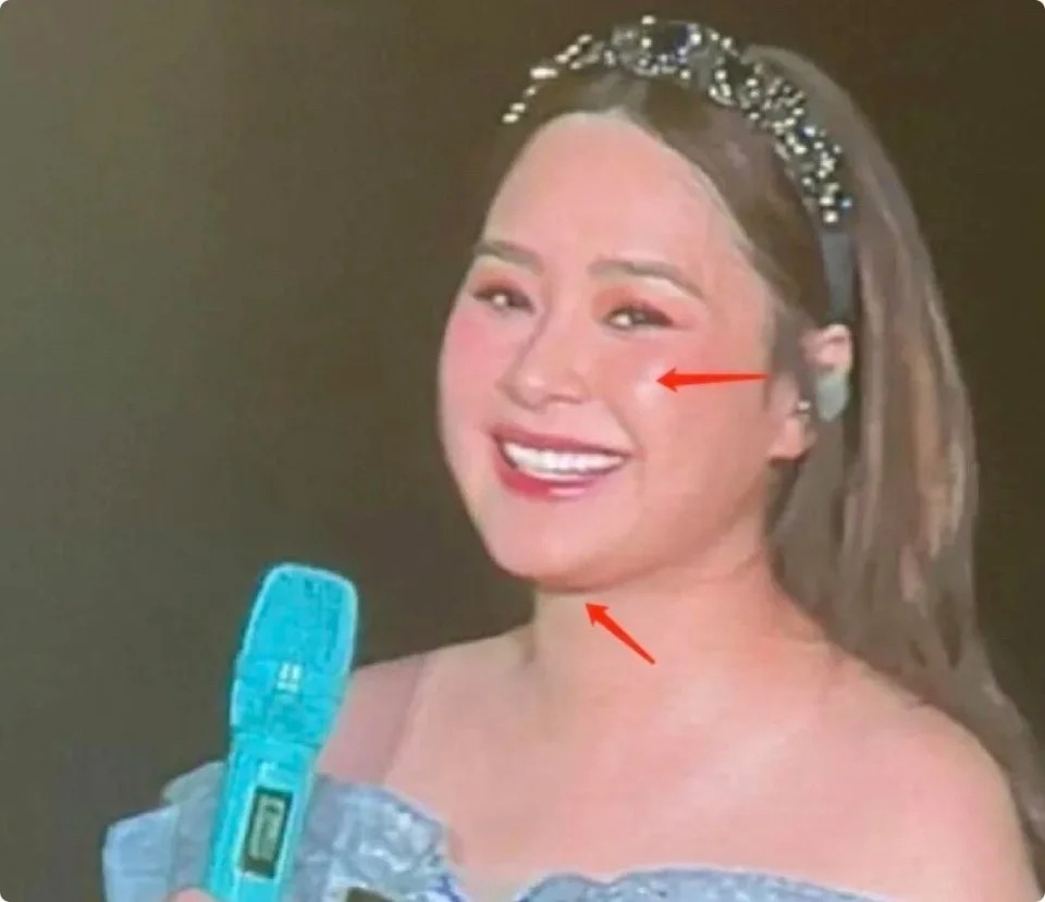 Ngoại hình phát tướng gây sốc của Chung Hân Đồng, đột ngột tăng đến 75 kg là vì sao?- Ảnh 2. Ngoại hình phát tướng gây sốc của Chung Hân Đồng