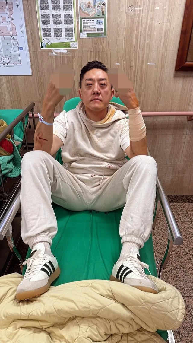 Hạ Thiên Luân bị 2 kẻ lạ mặt tấn công, chém thương tích Hình ảnh hiện trường vụ tấn công Hạ Thiên Luân